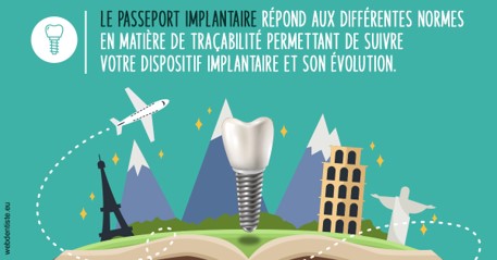 https://www.dentiste-pierre-bertrand-liege-jemeppe.be/Le passeport implantaire