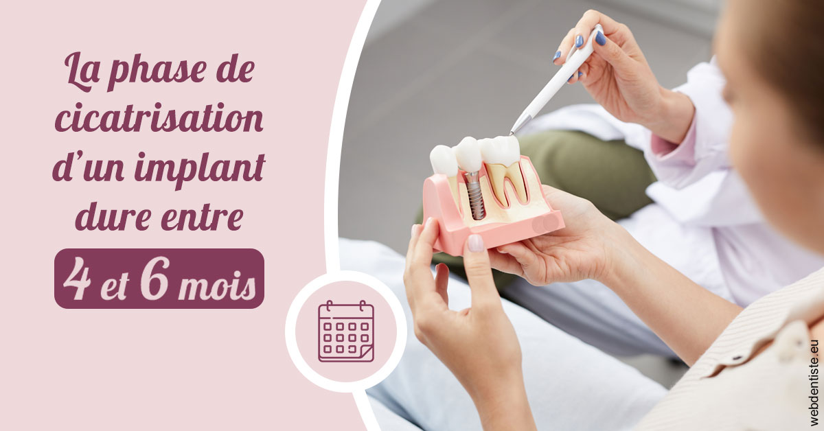 https://www.dentiste-pierre-bertrand-liege-jemeppe.be/Cicatrisation implant 2
