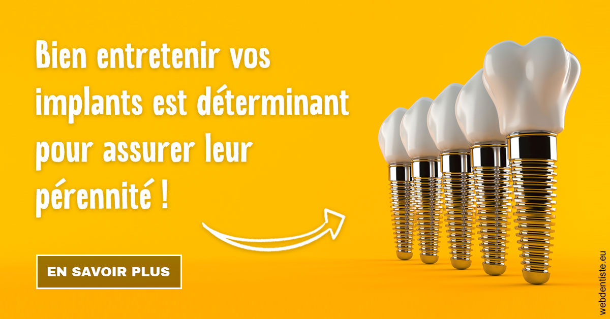 https://www.dentiste-pierre-bertrand-liege-jemeppe.be/Entretien implants 2