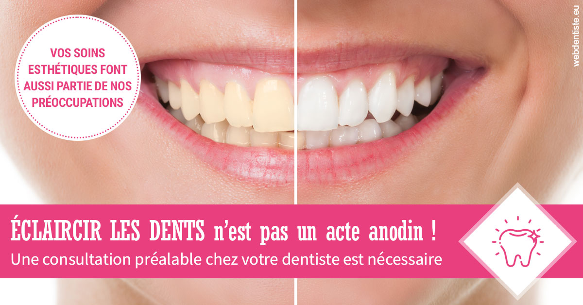 https://www.dentiste-pierre-bertrand-liege-jemeppe.be/2024 T1 - Eclaircir les dents 01