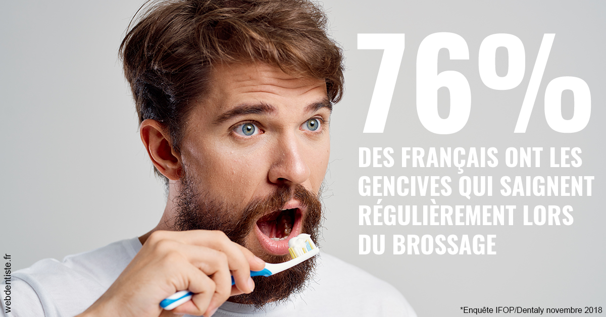 https://www.dentiste-pierre-bertrand-liege-jemeppe.be/76% des Français 2