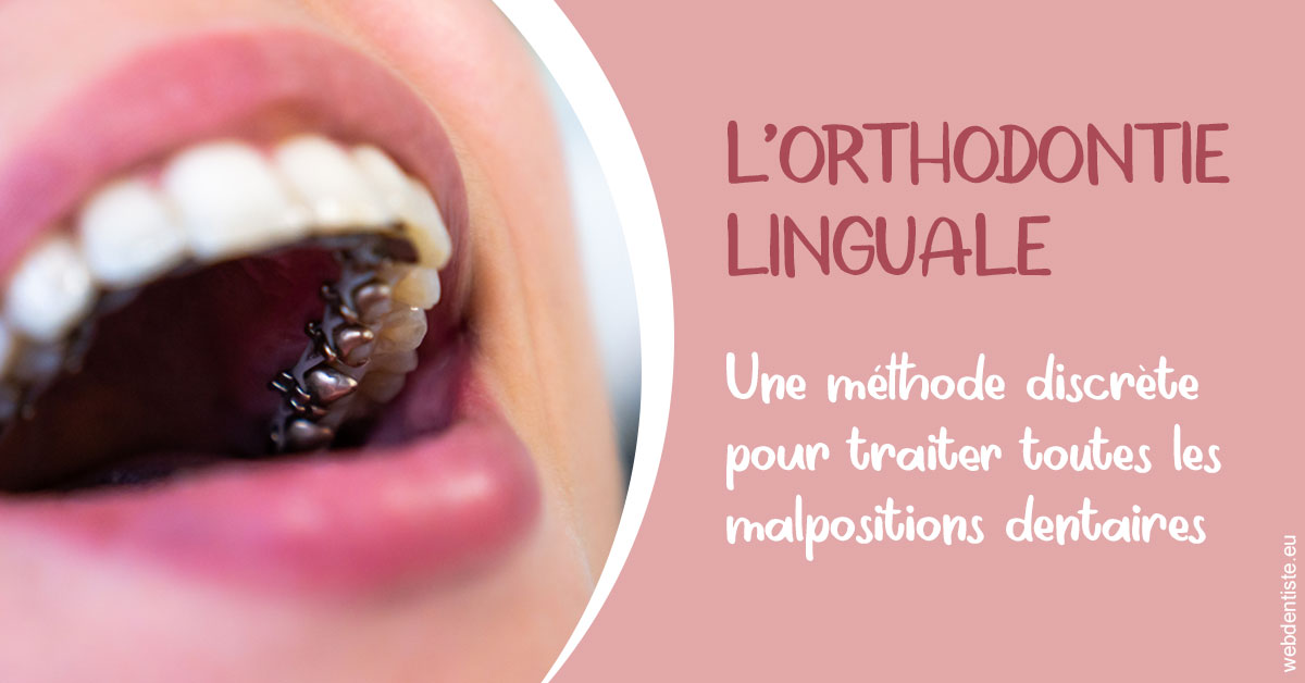 https://www.dentiste-pierre-bertrand-liege-jemeppe.be/L'orthodontie linguale 2