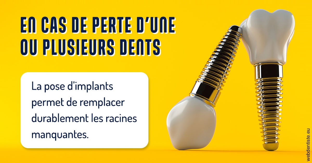 https://www.dentiste-pierre-bertrand-liege-jemeppe.be/2024 T1 - Implants 02