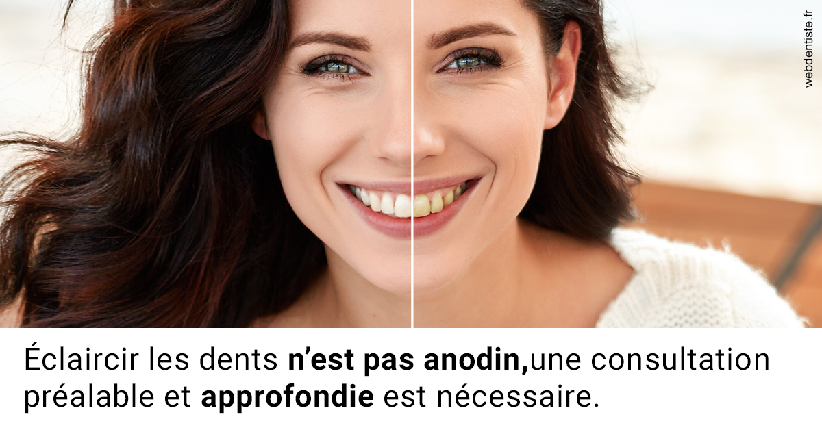 https://www.dentiste-pierre-bertrand-liege-jemeppe.be/Le blanchiment 2