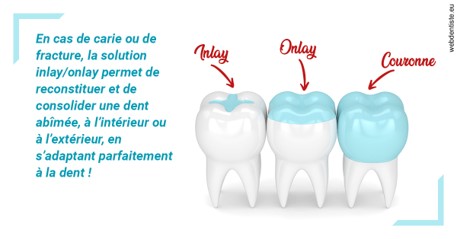 https://www.dentiste-pierre-bertrand-liege-jemeppe.be/L'INLAY ou l'ONLAY