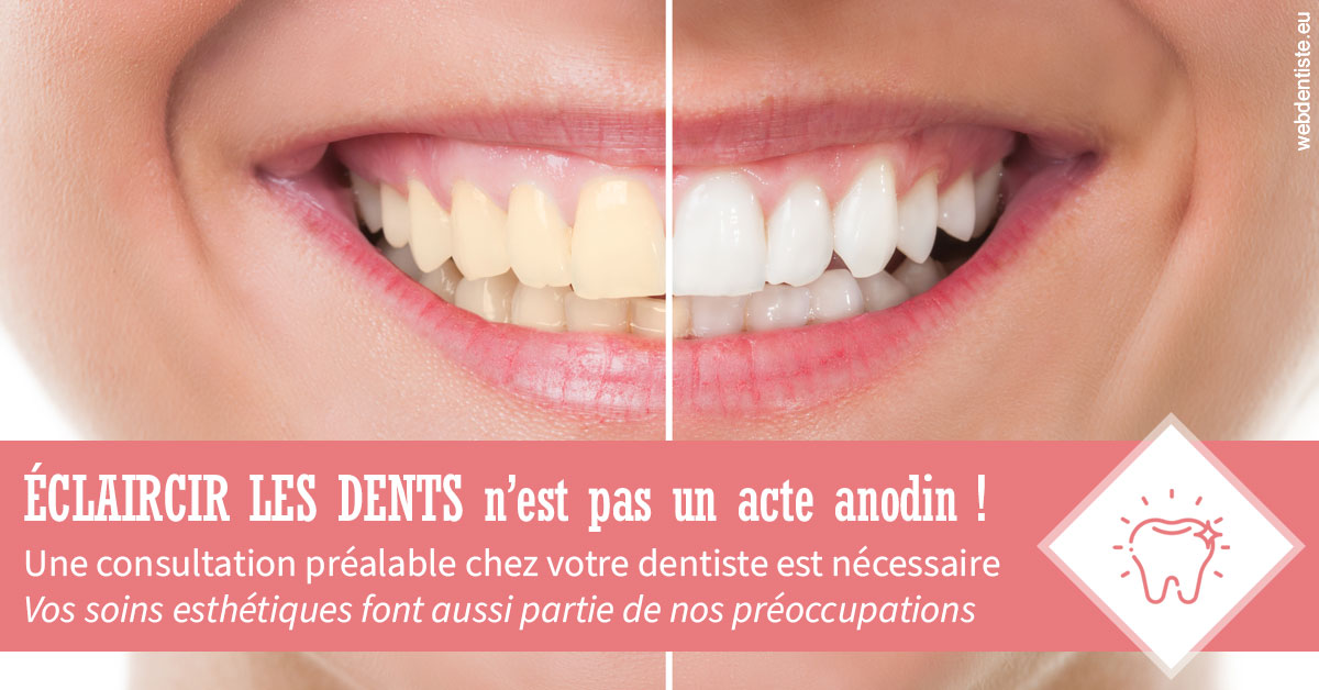 https://www.dentiste-pierre-bertrand-liege-jemeppe.be/Eclaircir les dents 1