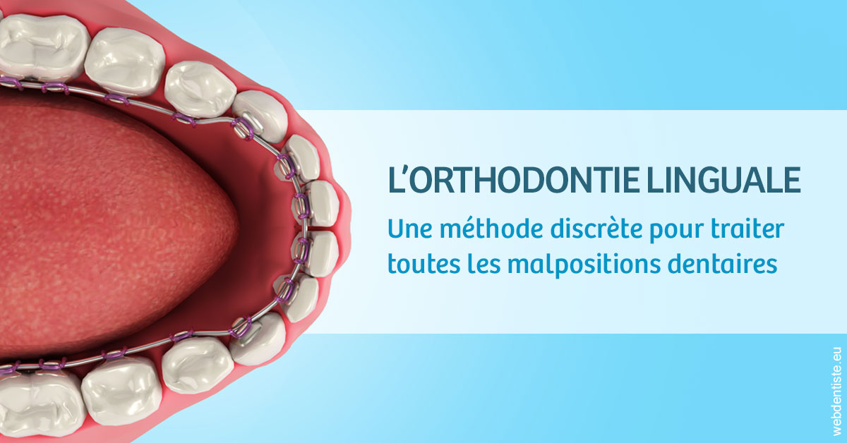https://www.dentiste-pierre-bertrand-liege-jemeppe.be/L'orthodontie linguale 1