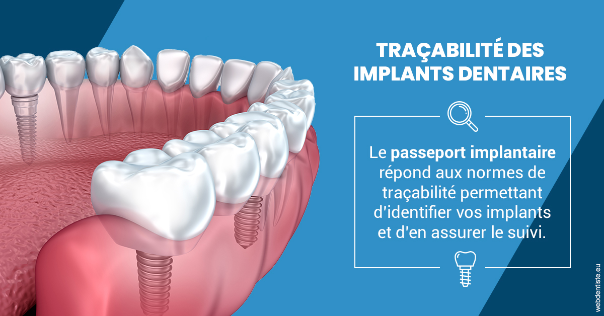 https://www.dentiste-pierre-bertrand-liege-jemeppe.be/T2 2023 - Traçabilité des implants 1