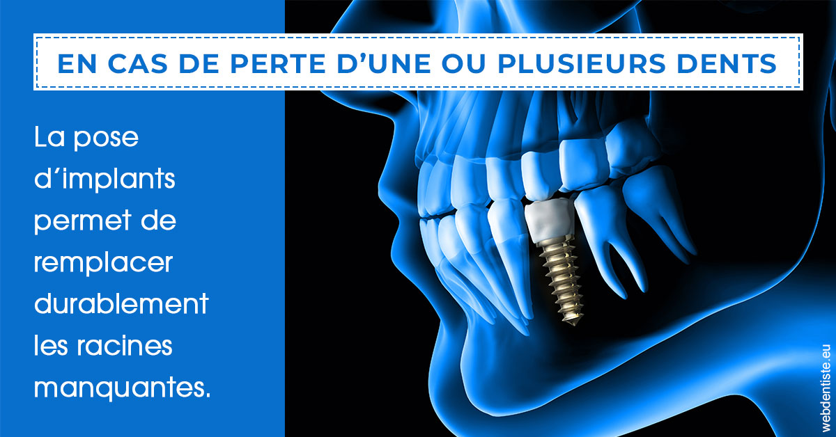 https://www.dentiste-pierre-bertrand-liege-jemeppe.be/2024 T1 - Implants 01