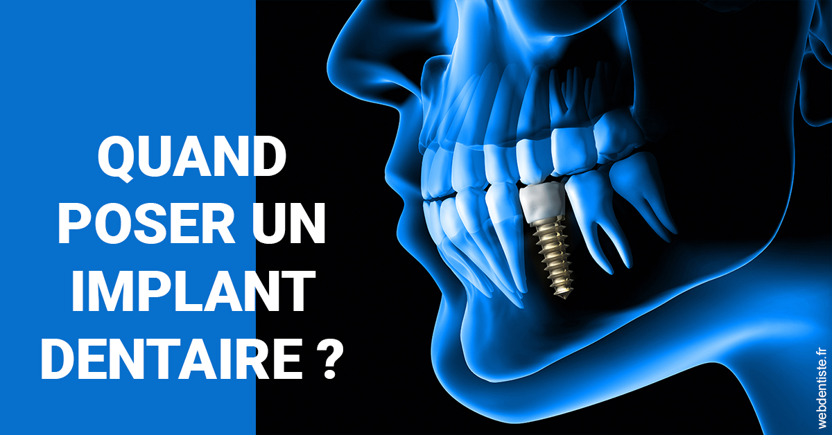 https://www.dentiste-pierre-bertrand-liege-jemeppe.be/Les implants 1