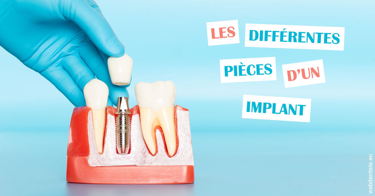 https://www.dentiste-pierre-bertrand-liege-jemeppe.be/Les différentes pièces d’un implant 2