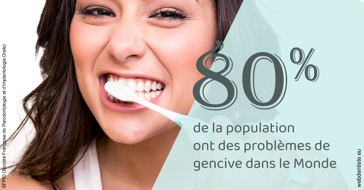 https://www.dentiste-pierre-bertrand-liege-jemeppe.be/Problèmes de gencive 1