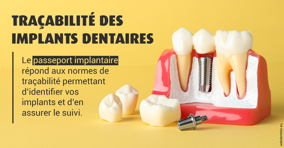 https://www.dentiste-pierre-bertrand-liege-jemeppe.be/T2 2023 - Traçabilité des implants 2