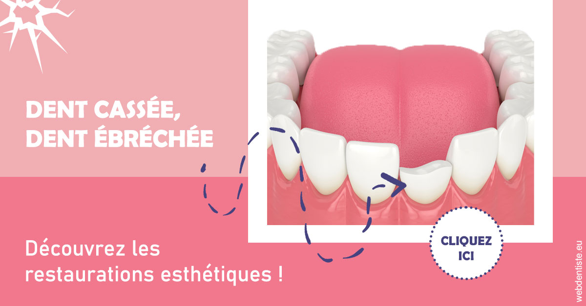 https://www.dentiste-pierre-bertrand-liege-jemeppe.be/Dent cassée ébréchée 1