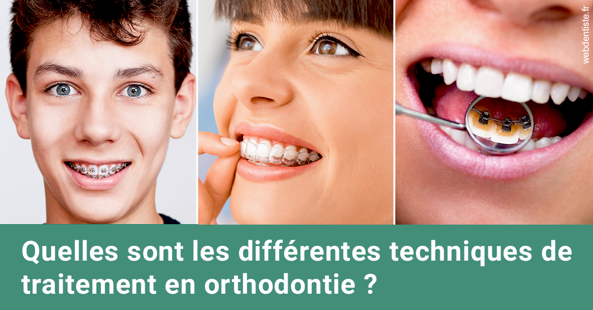 https://www.dentiste-pierre-bertrand-liege-jemeppe.be/Les différentes techniques de traitement 2