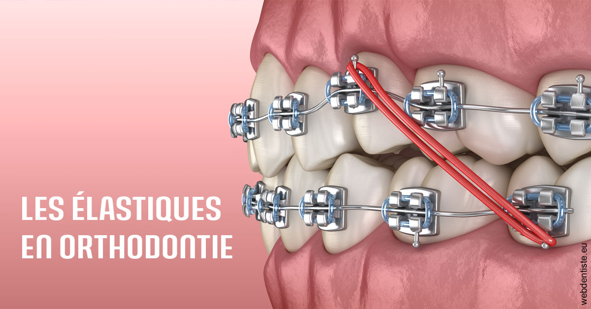 https://www.dentiste-pierre-bertrand-liege-jemeppe.be/Elastiques orthodontie 2