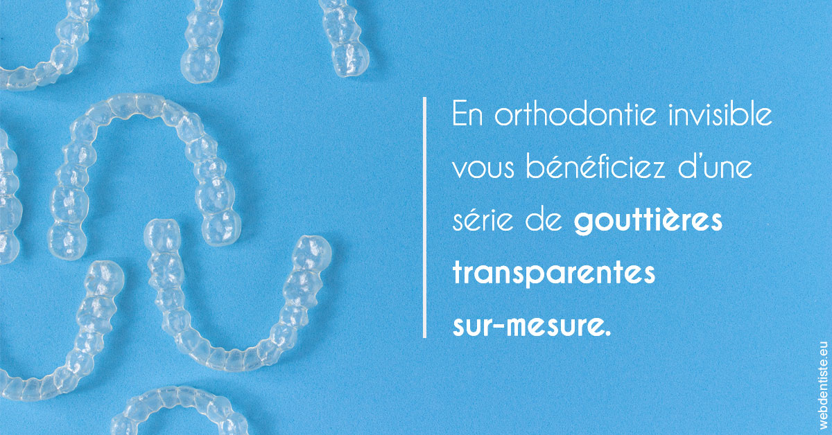 https://www.dentiste-pierre-bertrand-liege-jemeppe.be/Orthodontie invisible 2