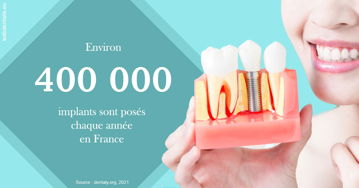 https://www.dentiste-pierre-bertrand-liege-jemeppe.be/Pose d'implants en France 2