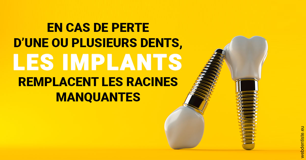 https://www.dentiste-pierre-bertrand-liege-jemeppe.be/Les implants 2