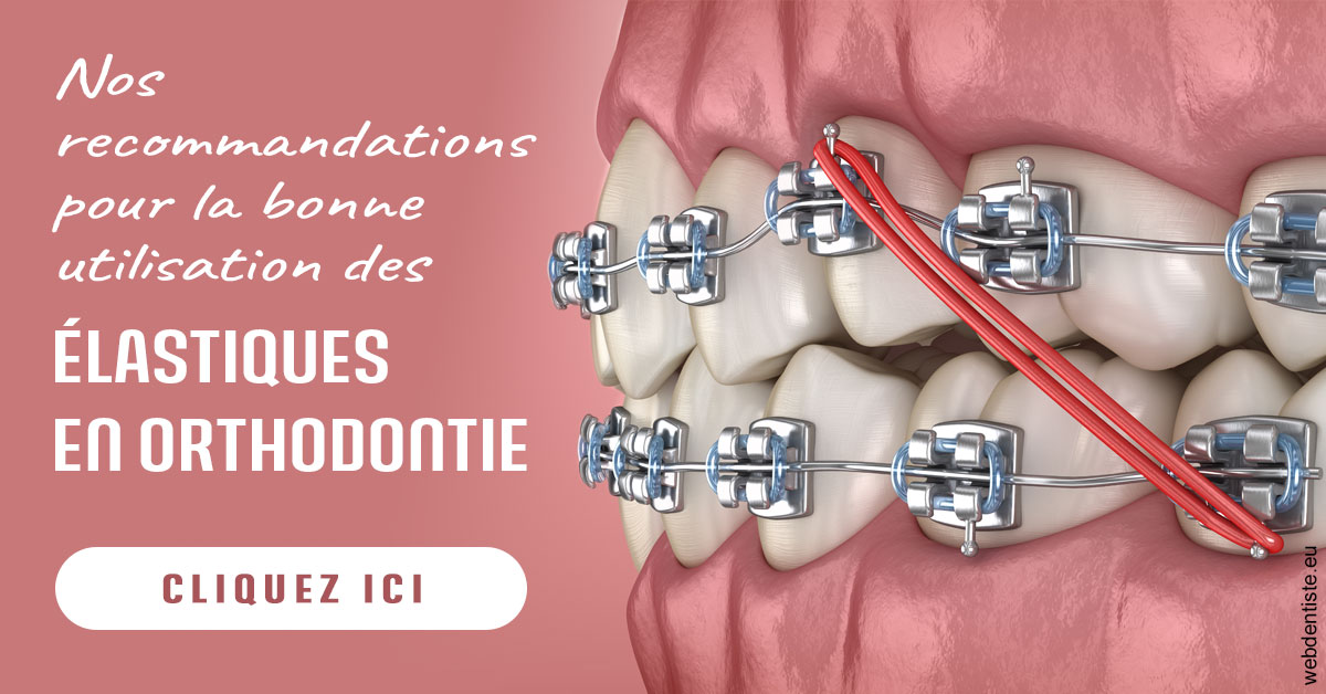 https://www.dentiste-pierre-bertrand-liege-jemeppe.be/Elastiques orthodontie 2