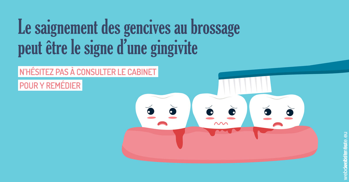 https://www.dentiste-pierre-bertrand-liege-jemeppe.be/2023 T4 - Saignement des gencives 02